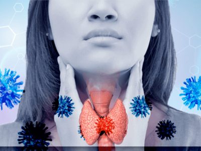 Хашимото - автоимунно заболяване на щитовидната жлеза - hashimoto