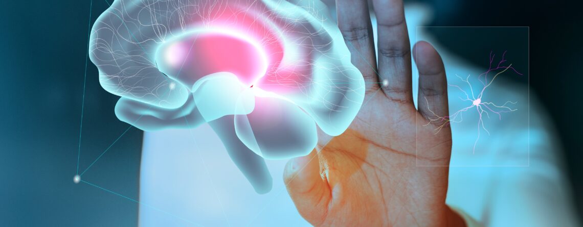 инсултът-мозък