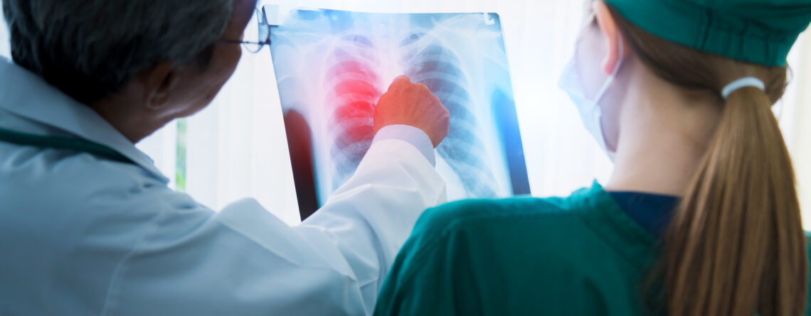 рак на белите дробове